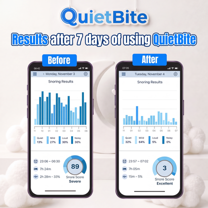 QuietBite 4.0™ Anti-Snoring Mouthpiece
